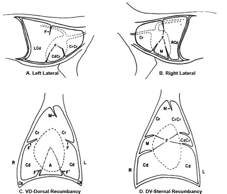 schematic drawing of pleural fissure locations
